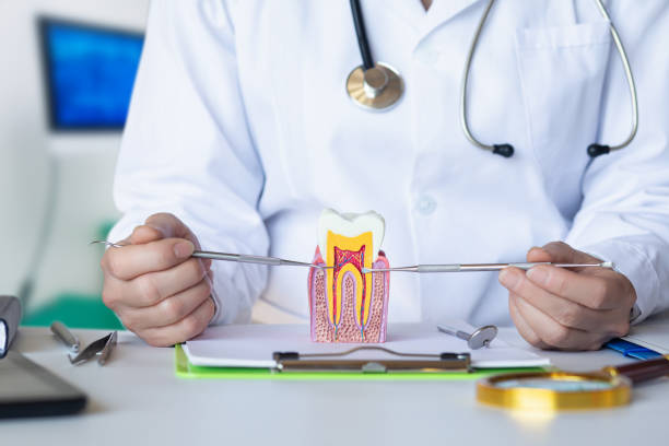 Best Knocked-Out Tooth (Avulsed Tooth) Treatment in Ponchatou, LA