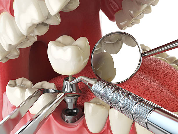 Best After-Hours Dental Care in Ponchatou, LA